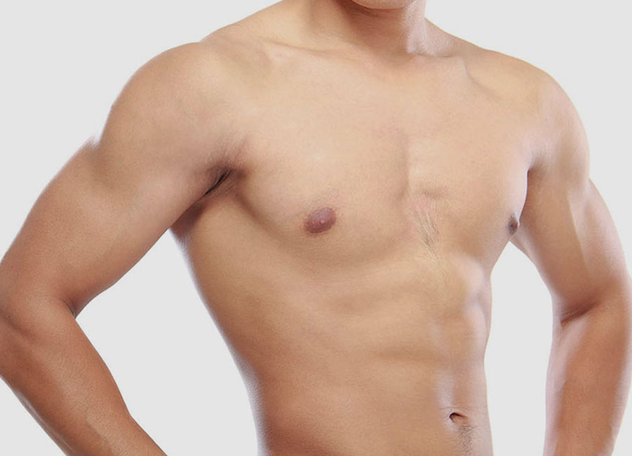 Gynäkomastie